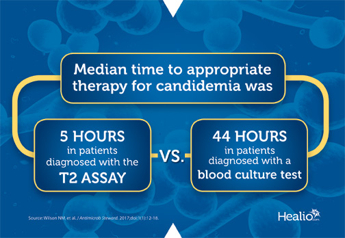 Median time to appropriate therapy for candidemia was 5 hours in patients diagnosed with the novel T2 assay compared with 44 hours in patients diagnosed with a blood culture test.