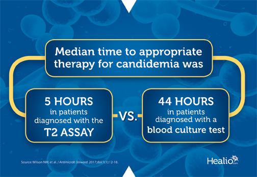 采用新型T2测定法诊断的患者接受念珠菌病适当治疗的中位时间为5小时，而采用血液培养试验诊断的患者为44小时。