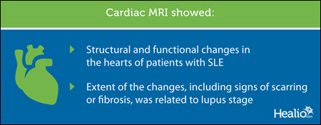 Cardiac MRI graphic